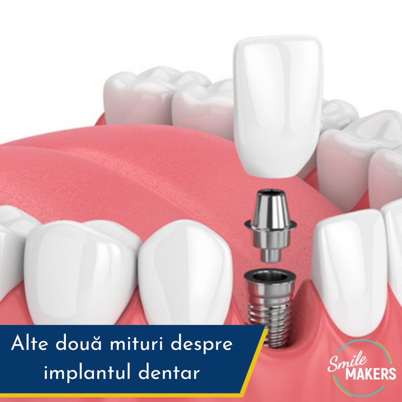 Smile Makers - Clinica Stomatologica